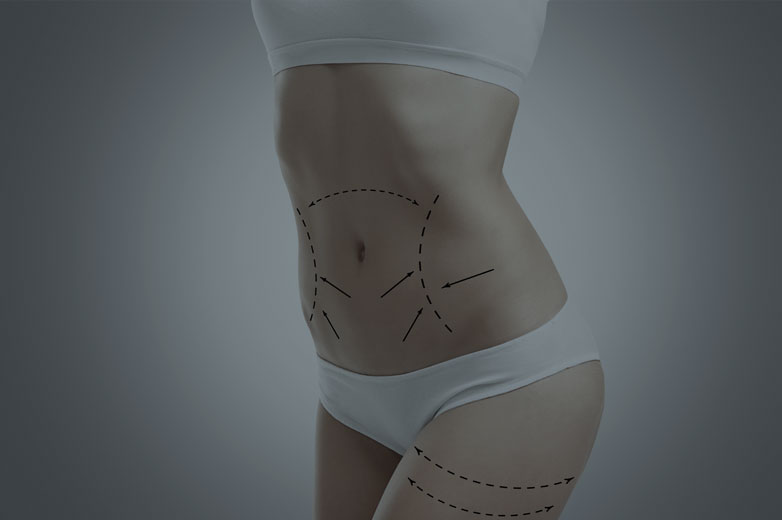 vignette-lipo