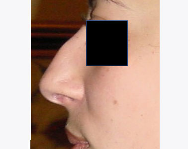 R02-before