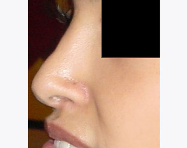 R03-after