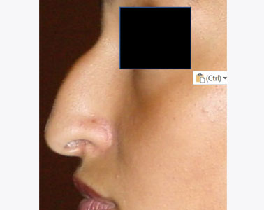 R03-before