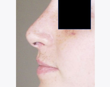 R04-after
