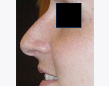 R04-before