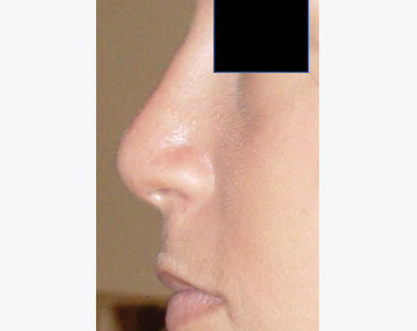 R05-after
