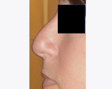 R05-before