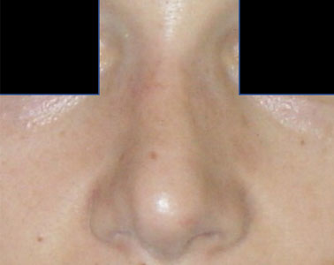 R06-after