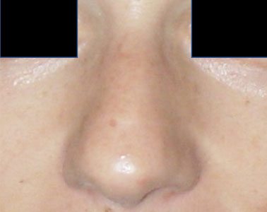 R06-before