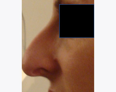R07-before