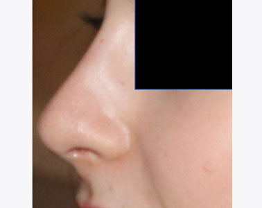 R08-after