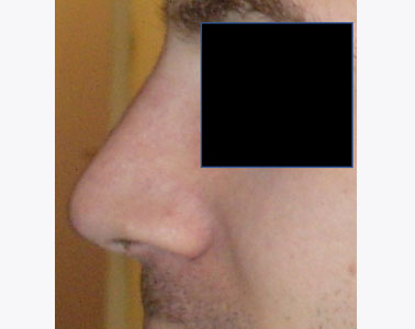 R09-after