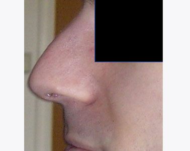R09-before