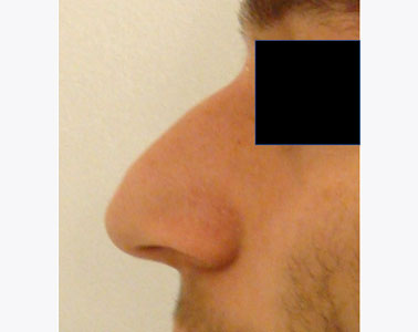 R10-before
