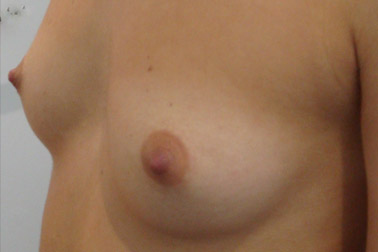 01before