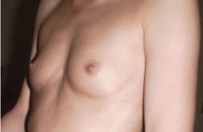 6a